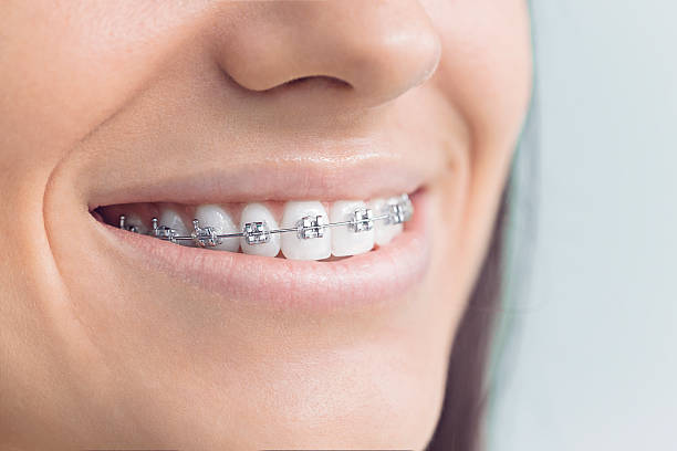 Best Full Mouth Reconstruction  in Pleasanton, TX